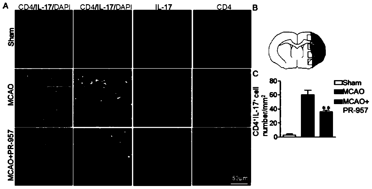 Application of pr-957 in preparing medicine for treating cerebral ischemia-reperfusion injury