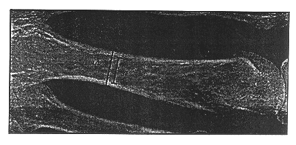 Method of estimating skeletal status