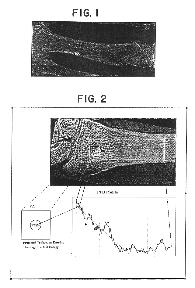 Method of estimating skeletal status