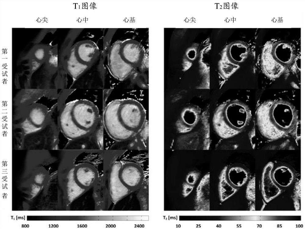 Quantitative myocardial magnetic resonance imaging method, equipment and storage medium