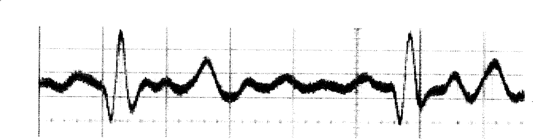 Monitoring system of physiological parameter