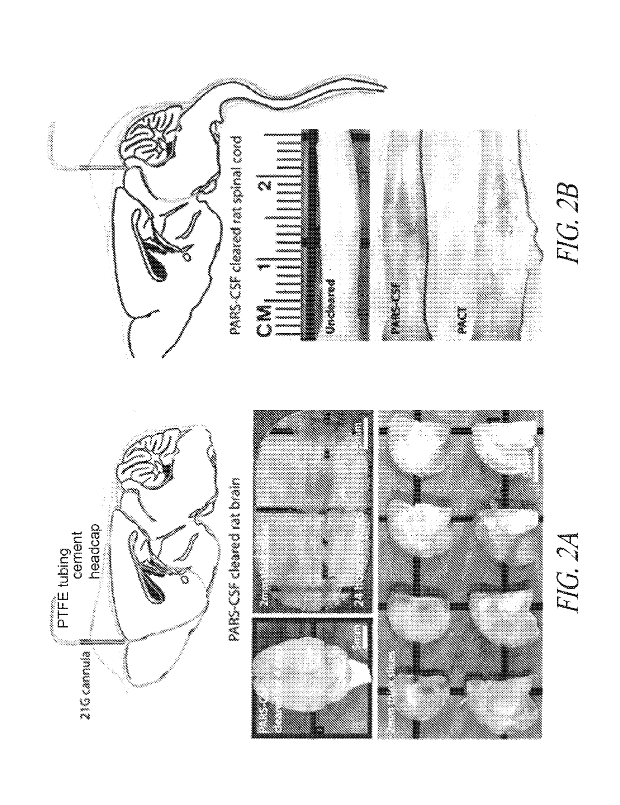 Methods for preparing and analyzing tumor tissue samples for detection and monitoring of cancers