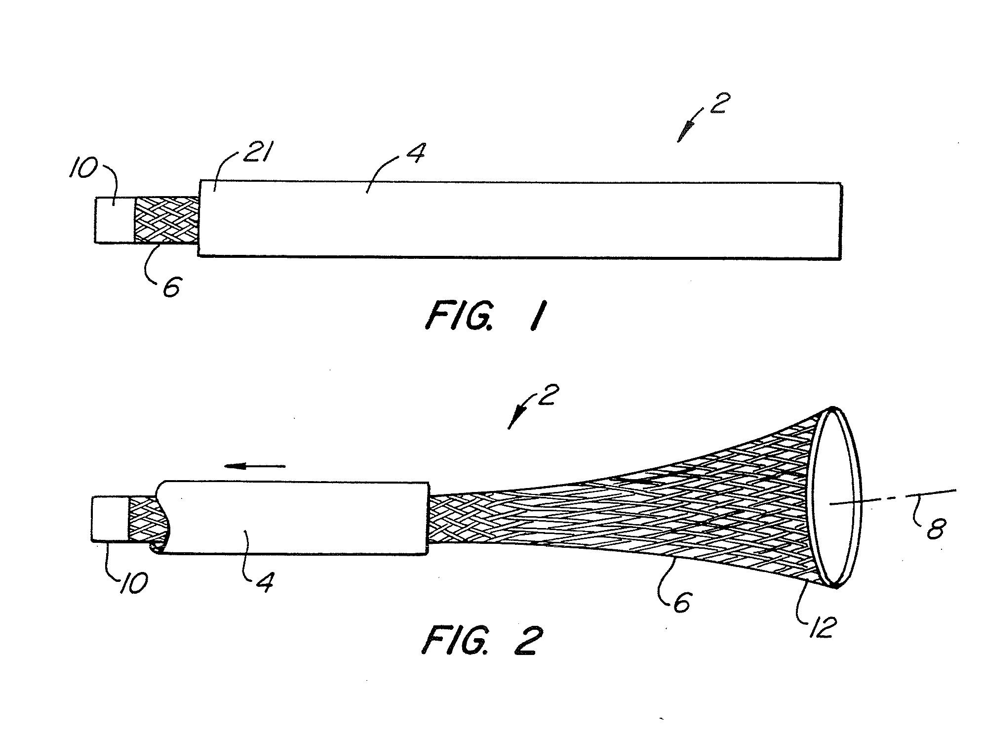 Upper Airway Device and Method