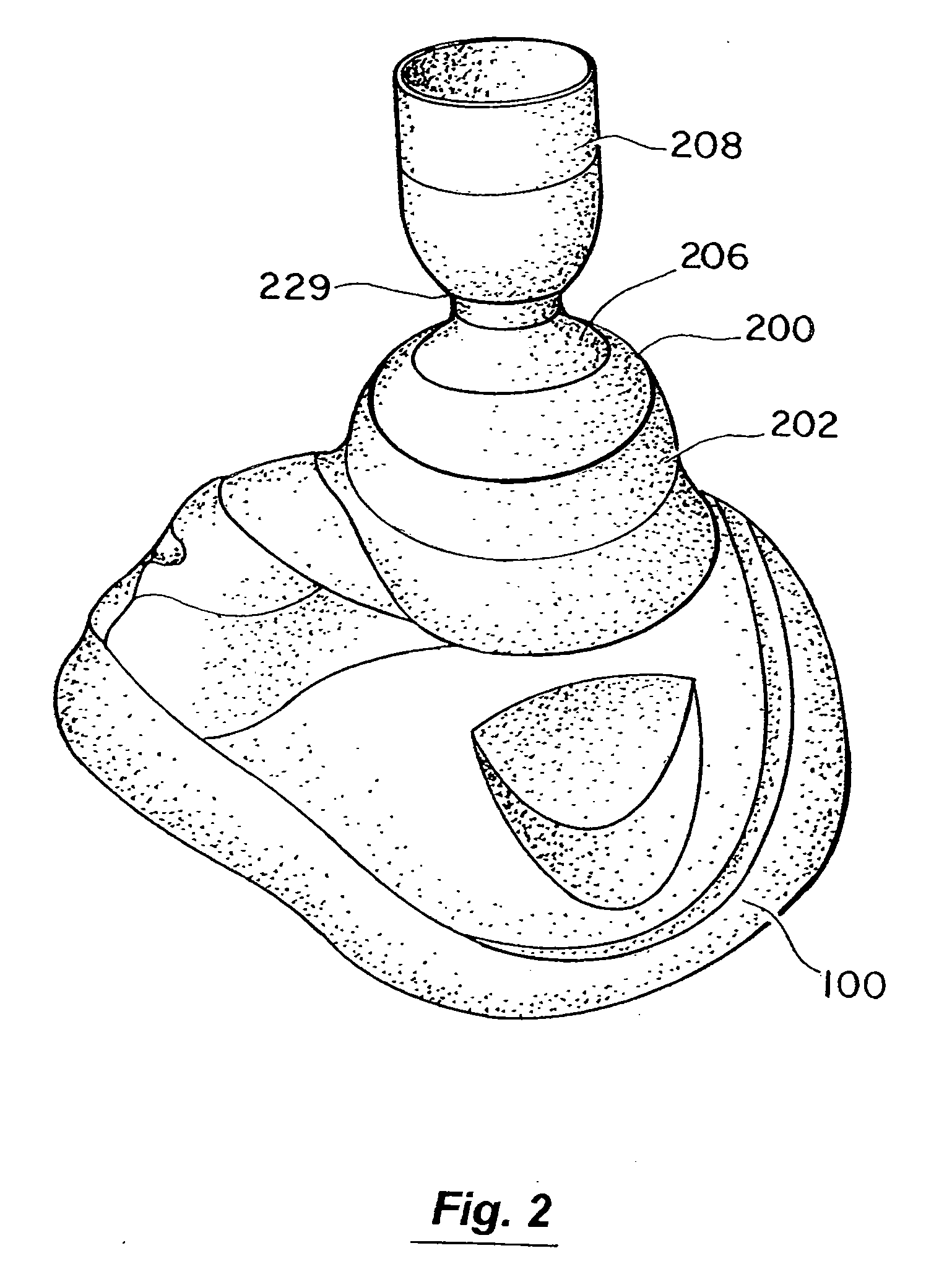 System for sensing, diagnosing and treating physiological conditions and methods