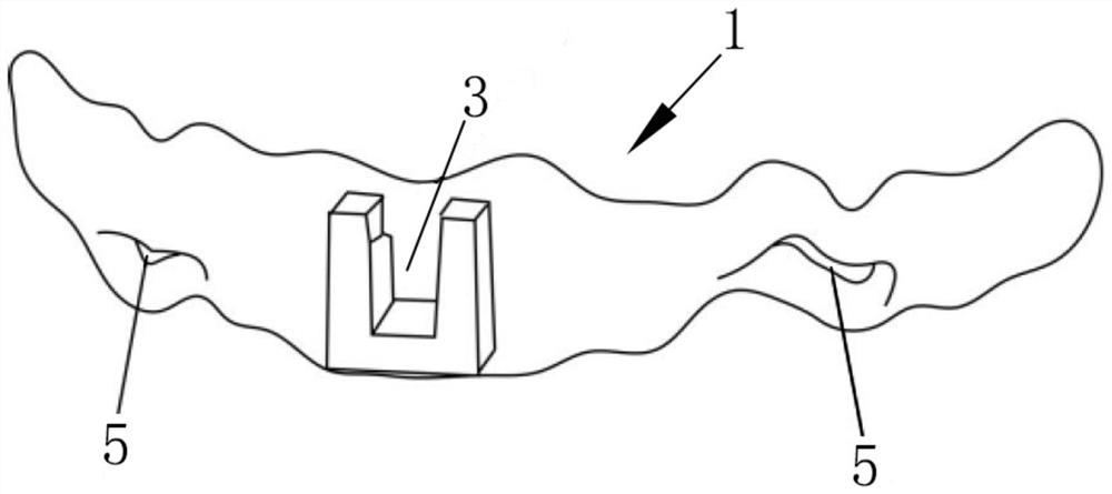 Periosteum nail position and direction positioning guide plate in GBR and manufacturing method thereof