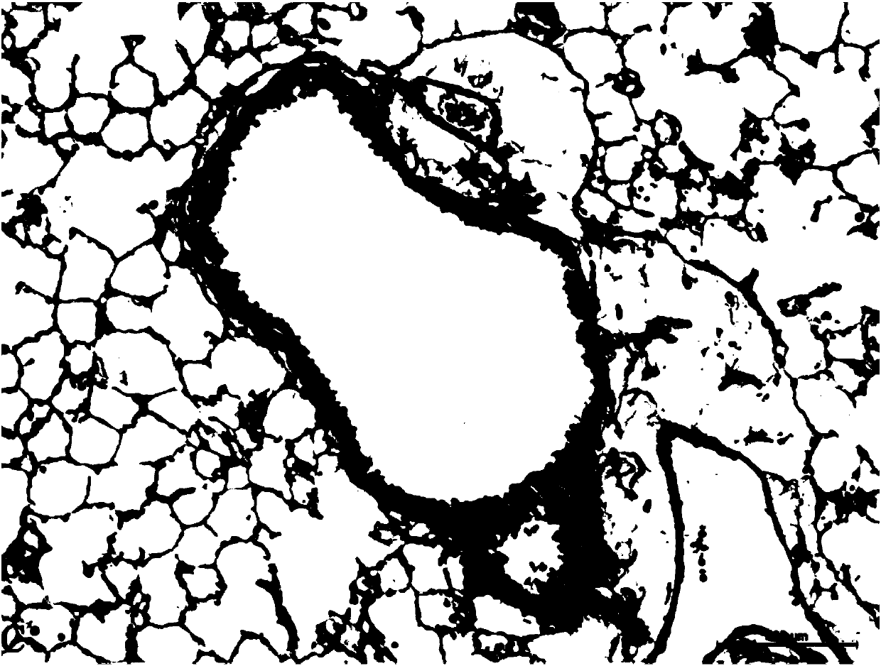 Noninvasive pulmonary fibrosis model building method