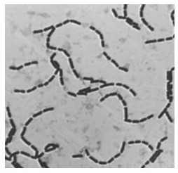 A strain of Lactobacillus paracasei and its application