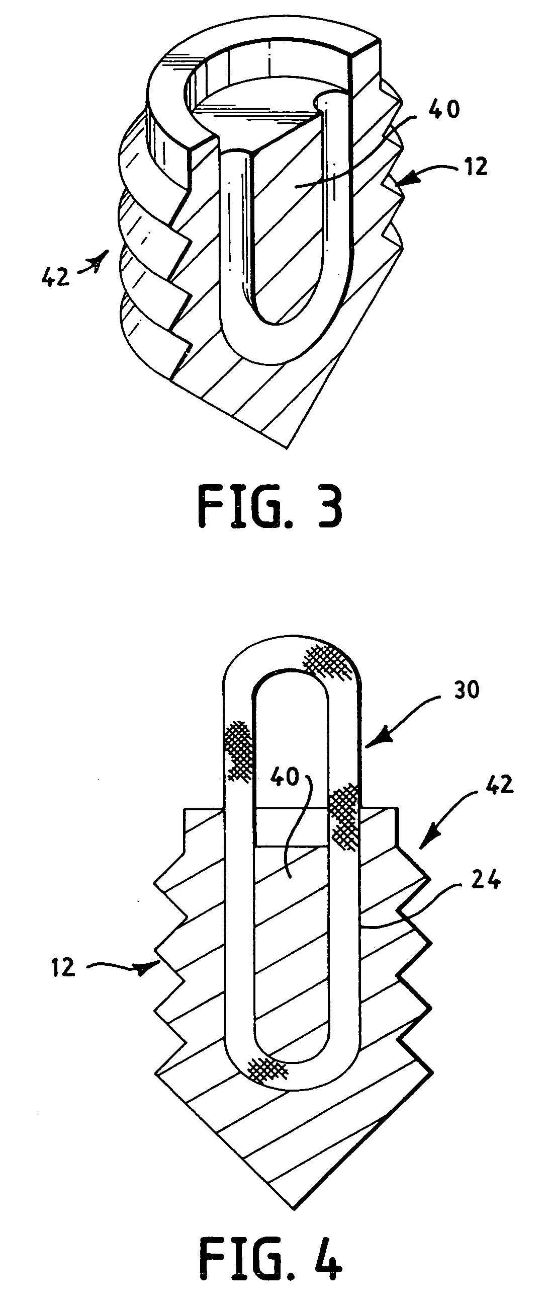 Apparatus and method for securing suture to bone