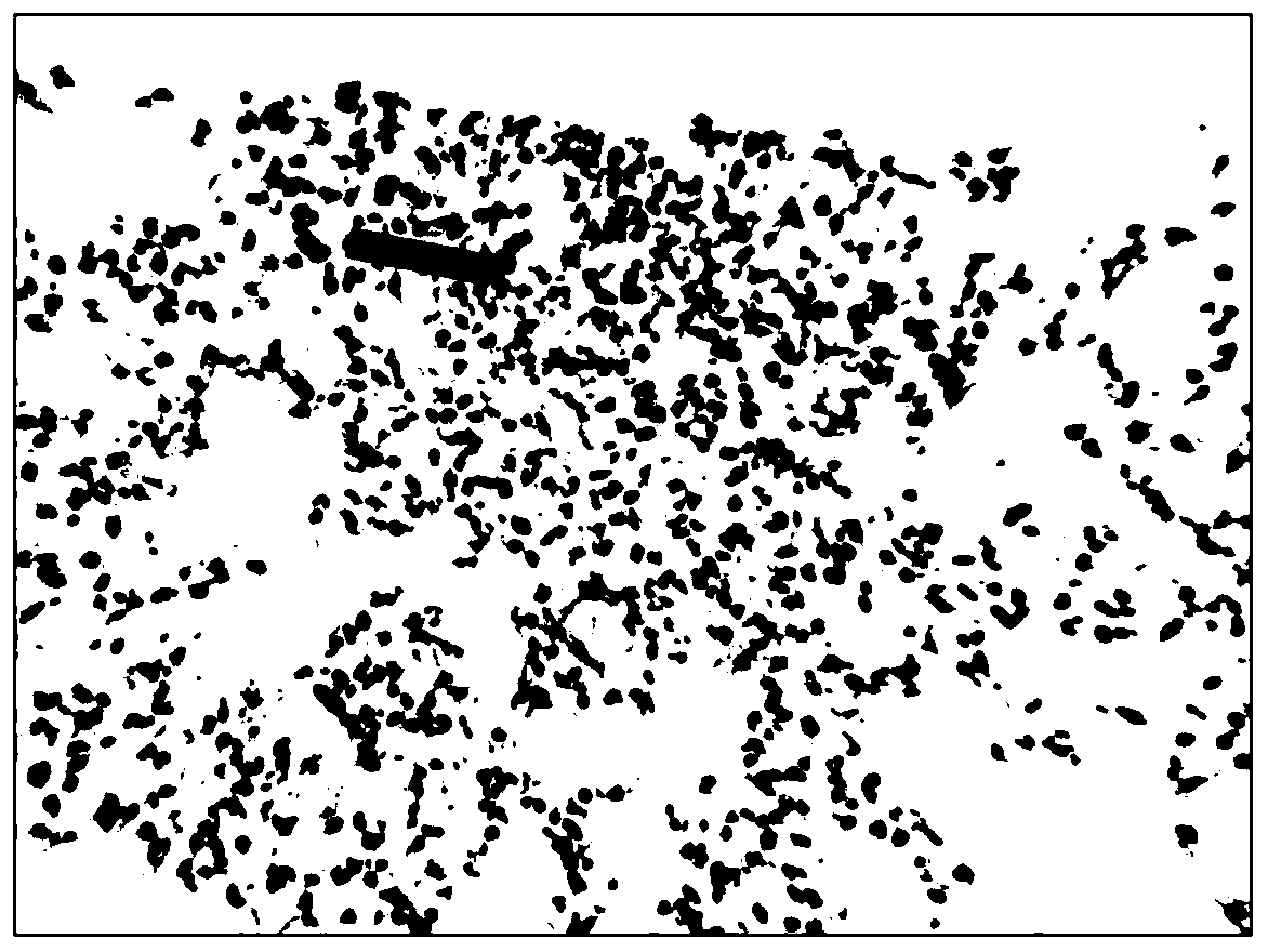 Traditional Chinese medicine particles capable of treating novel coronavirus (COVID-19) pneumonia, preparation method of traditional Chinese medicine particles capable of treating novel coronavirus pneumonia and transdermal patch capable of treating novel coronavirus pneumonia