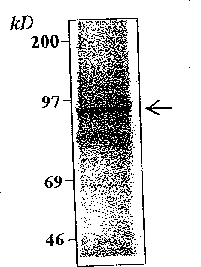 An i(in vitro) activity assay for human hepatitis B virus (HBV) DNA polymerase, and its use for screening for inhibitors of HBV DNA polymerase