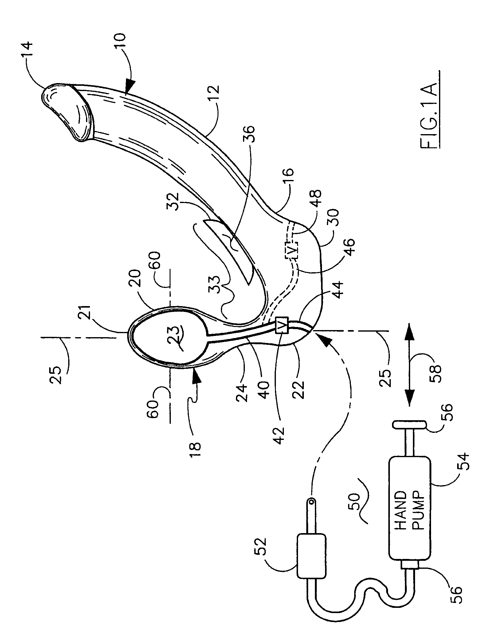 Erogenic stimulator with expandable bulbous end