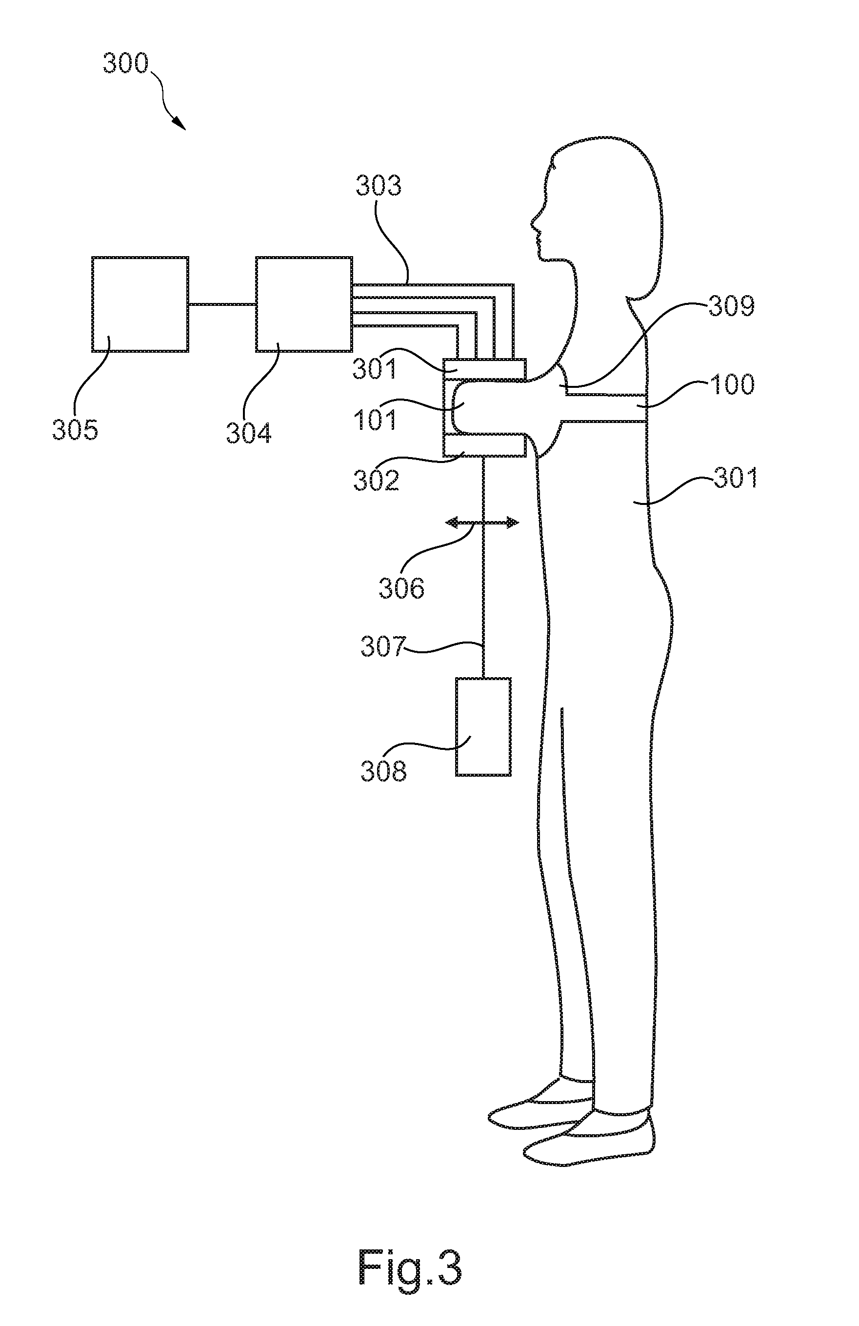 Interface device, imaging system and method for rim-imaging