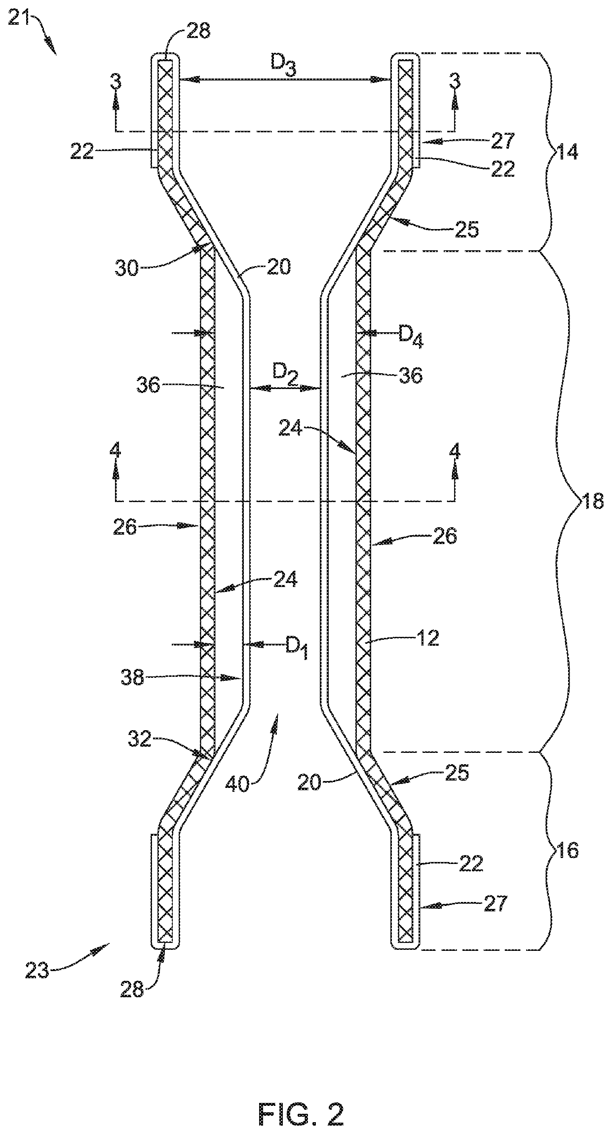 Esophageal stent including an inner liner