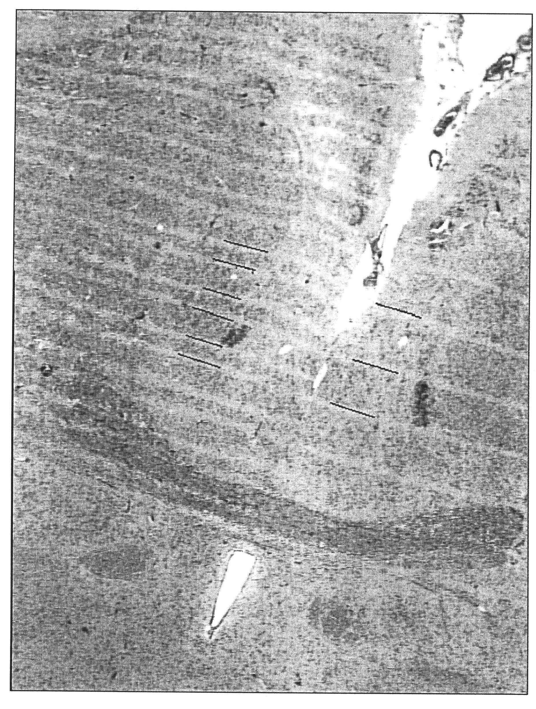 Compact microbeam radiation therapy systems and methods for cancer treatment and research