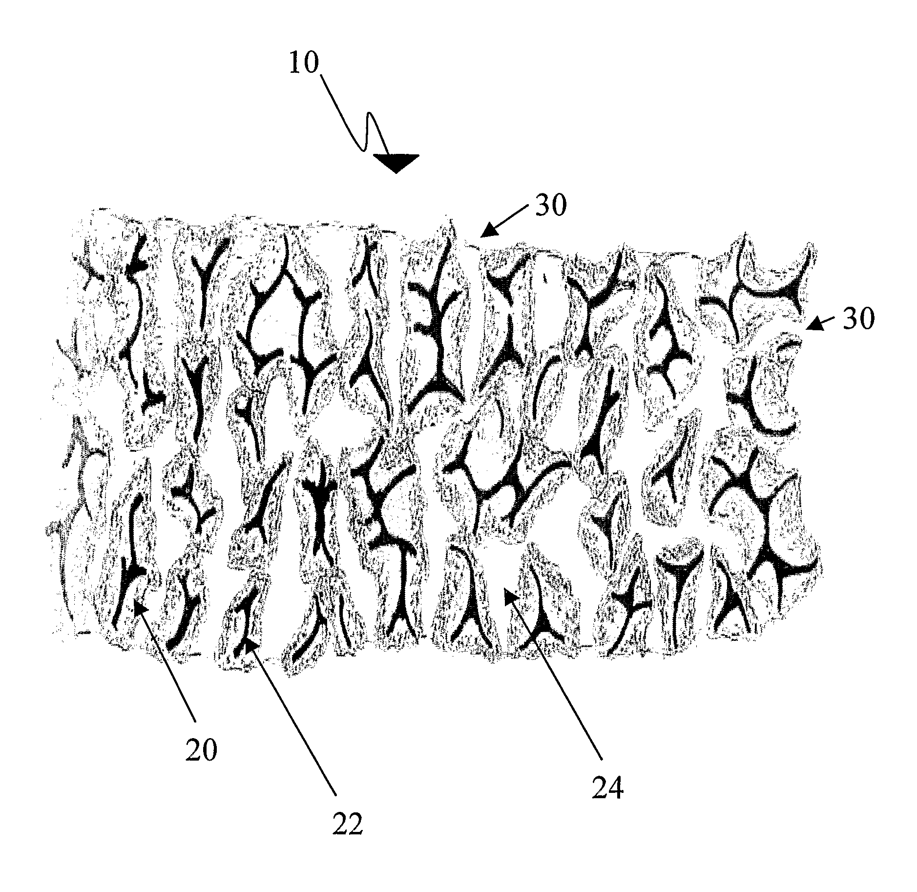 Interface layer wound dressing