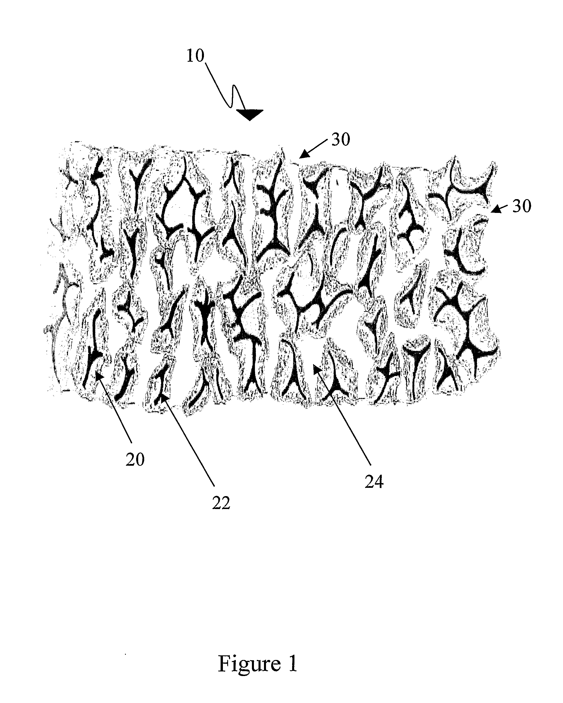 Interface layer wound dressing