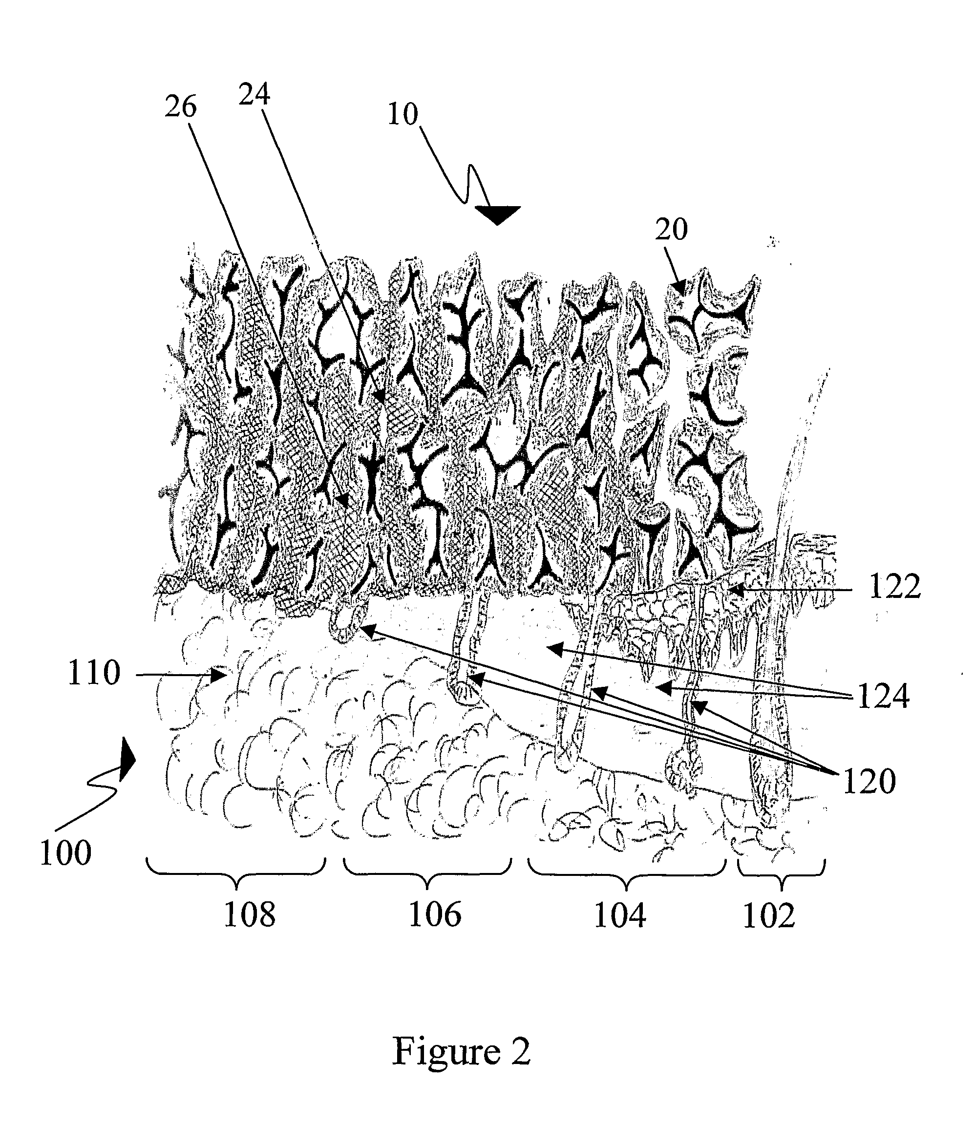 Interface layer wound dressing