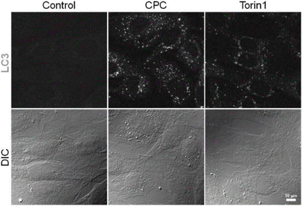 Application of alkyl pyridine compound to preparation of medicine for inducing cell autophagy and method for inducing cell autophagy