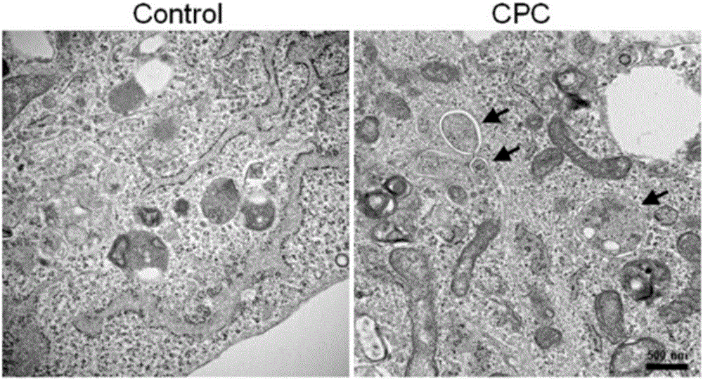 Application of alkyl pyridine compound to preparation of medicine for inducing cell autophagy and method for inducing cell autophagy