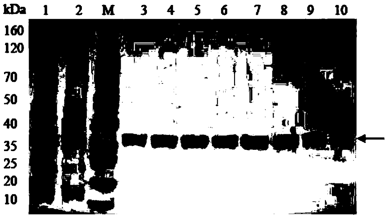 Method for preparing P2X7R (purinergic ligand-gated ion channel 7 receptor) immunogen