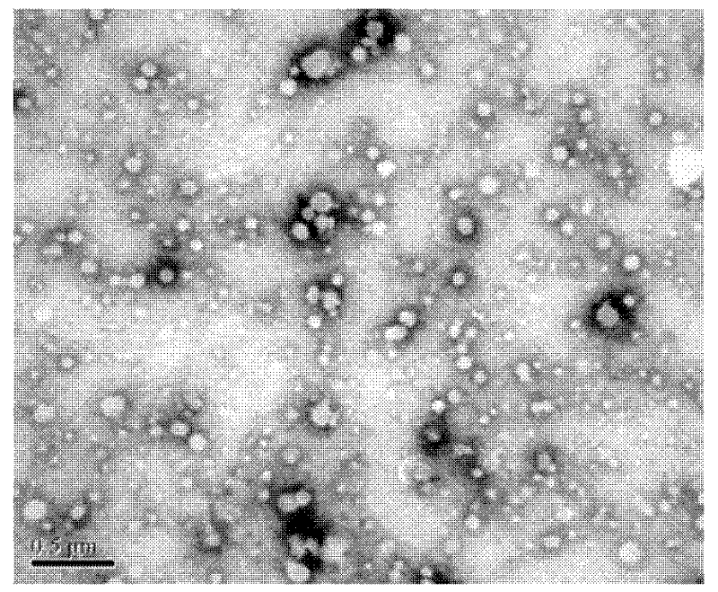 Mitoxantrone targeting sustained-release long-circulating nanometer liposome and preparation method