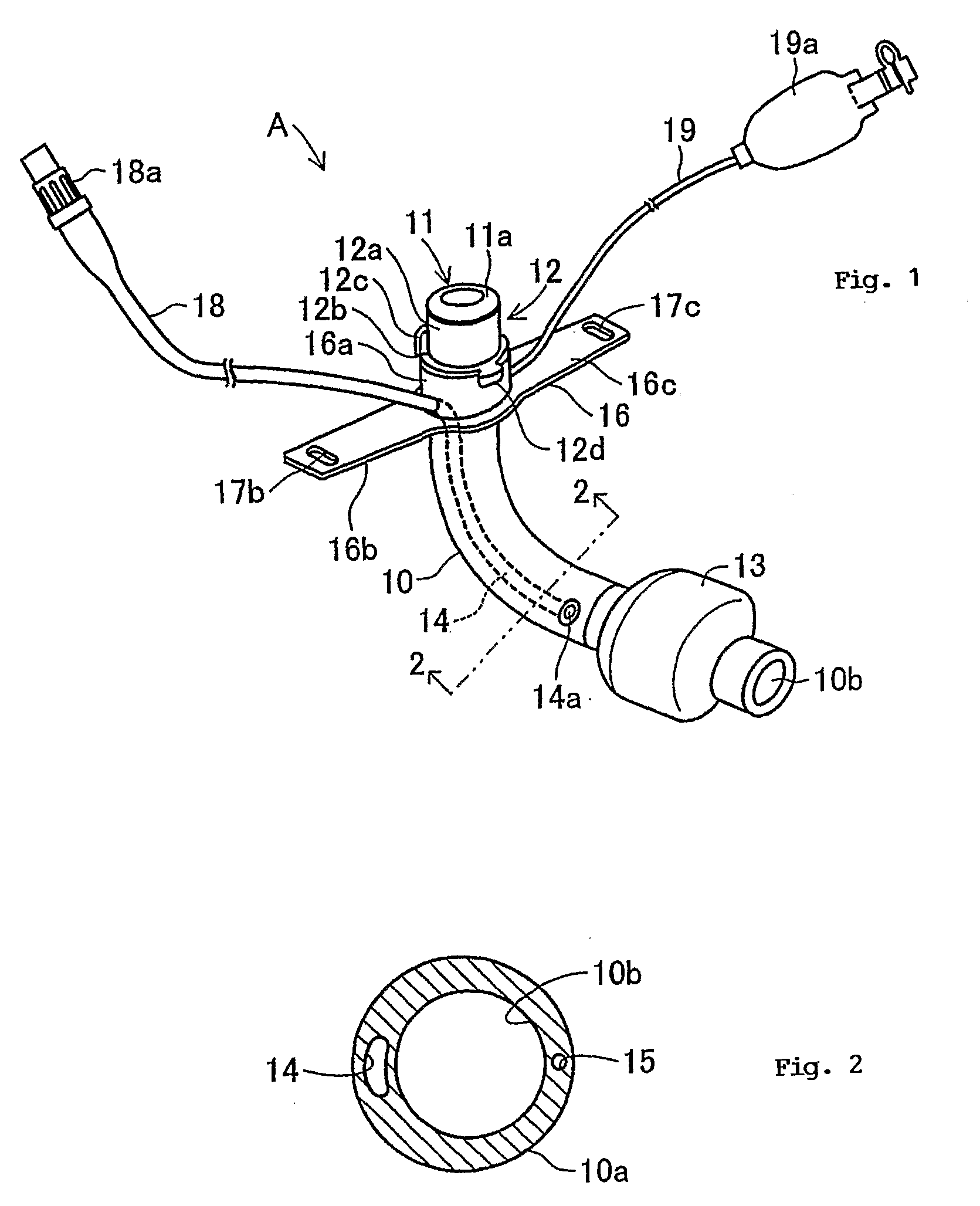 Tracheostomy Tube