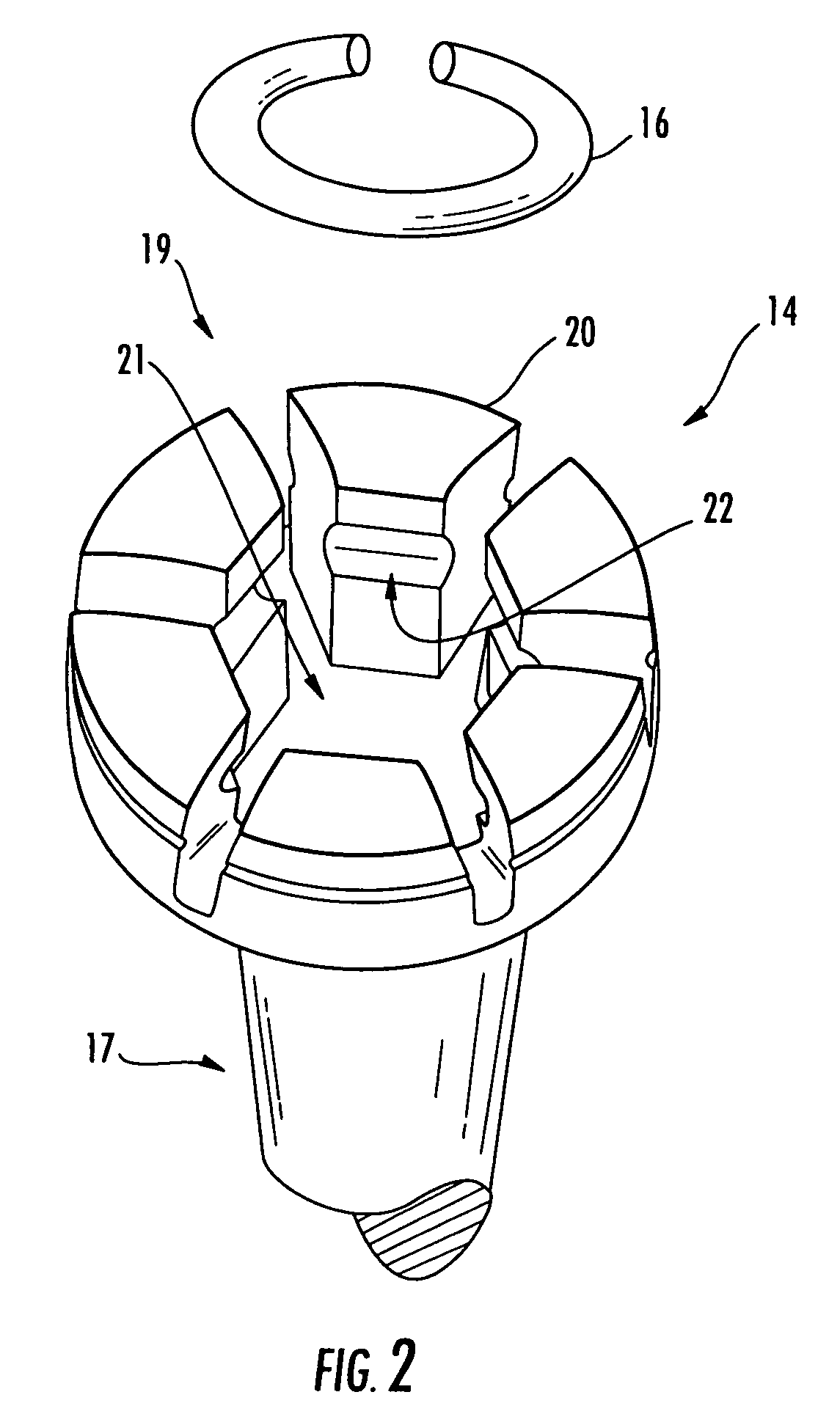 Cervical plate locking mechanism and associated surgical method