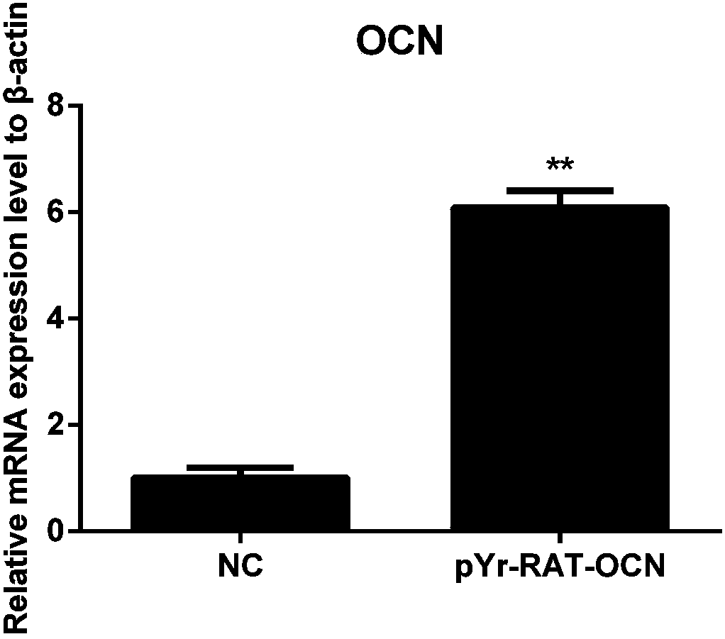 Application of osteocalcin to regulation of exosomes of endothelial progenitor cells