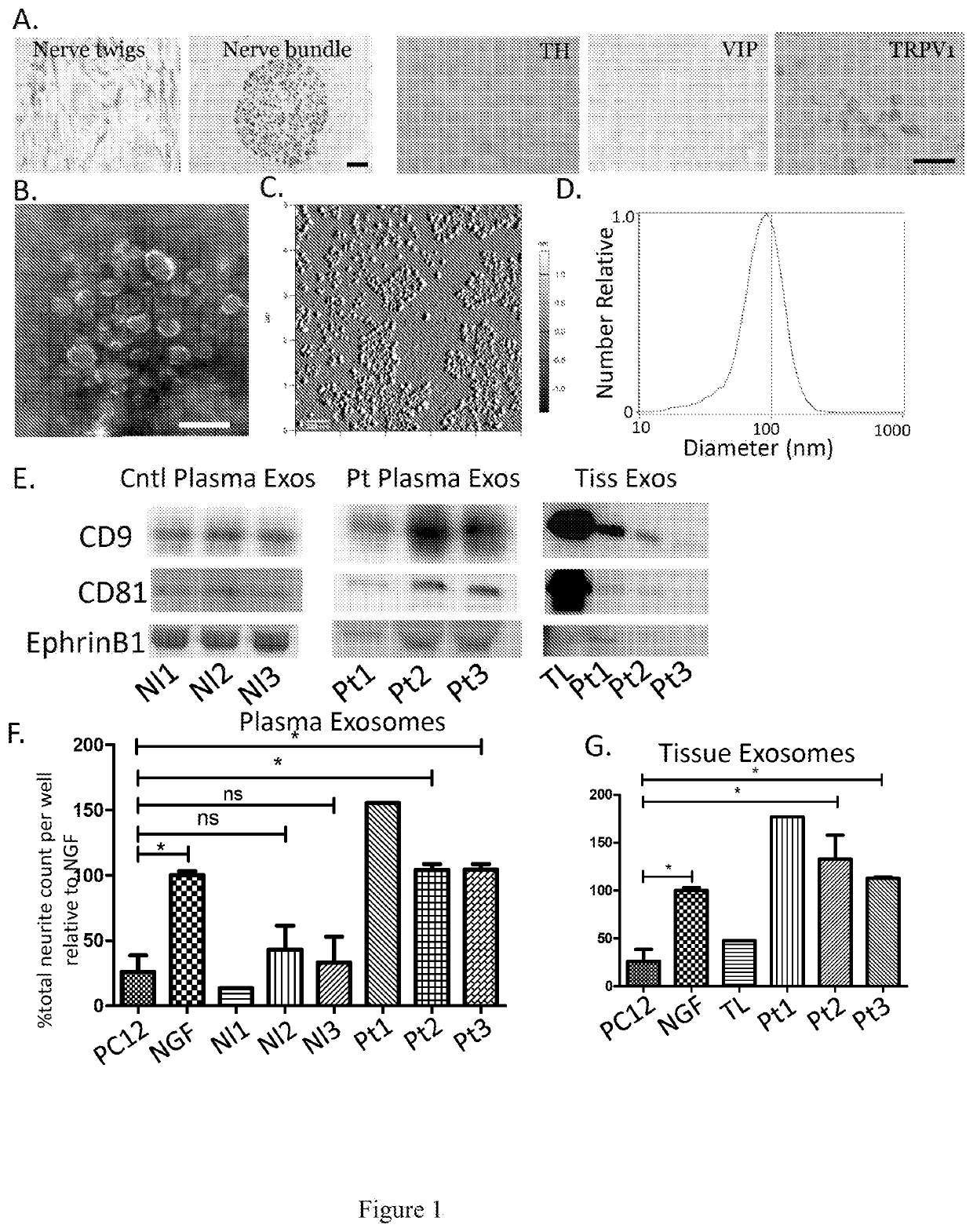 Inhibitors of ephrin b1 for tumor treatment