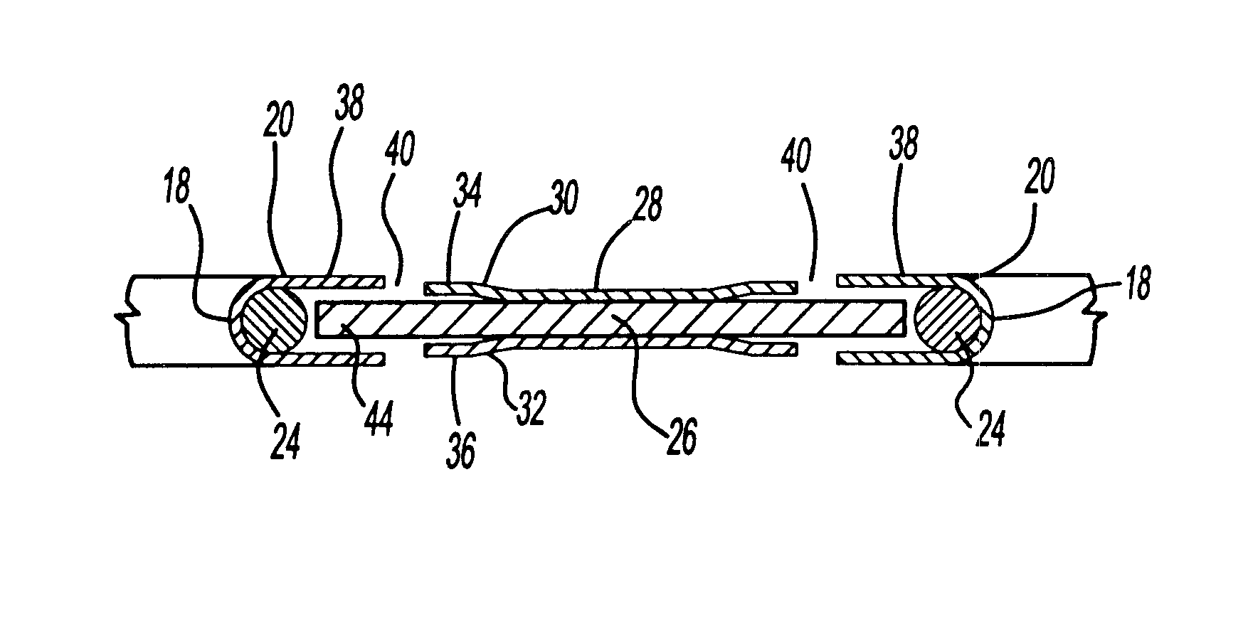 MLS gasket with wire ring stopper