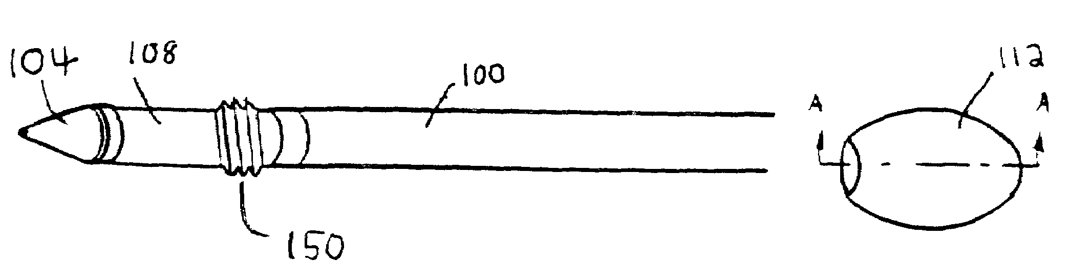 Tissue dissector apparatus