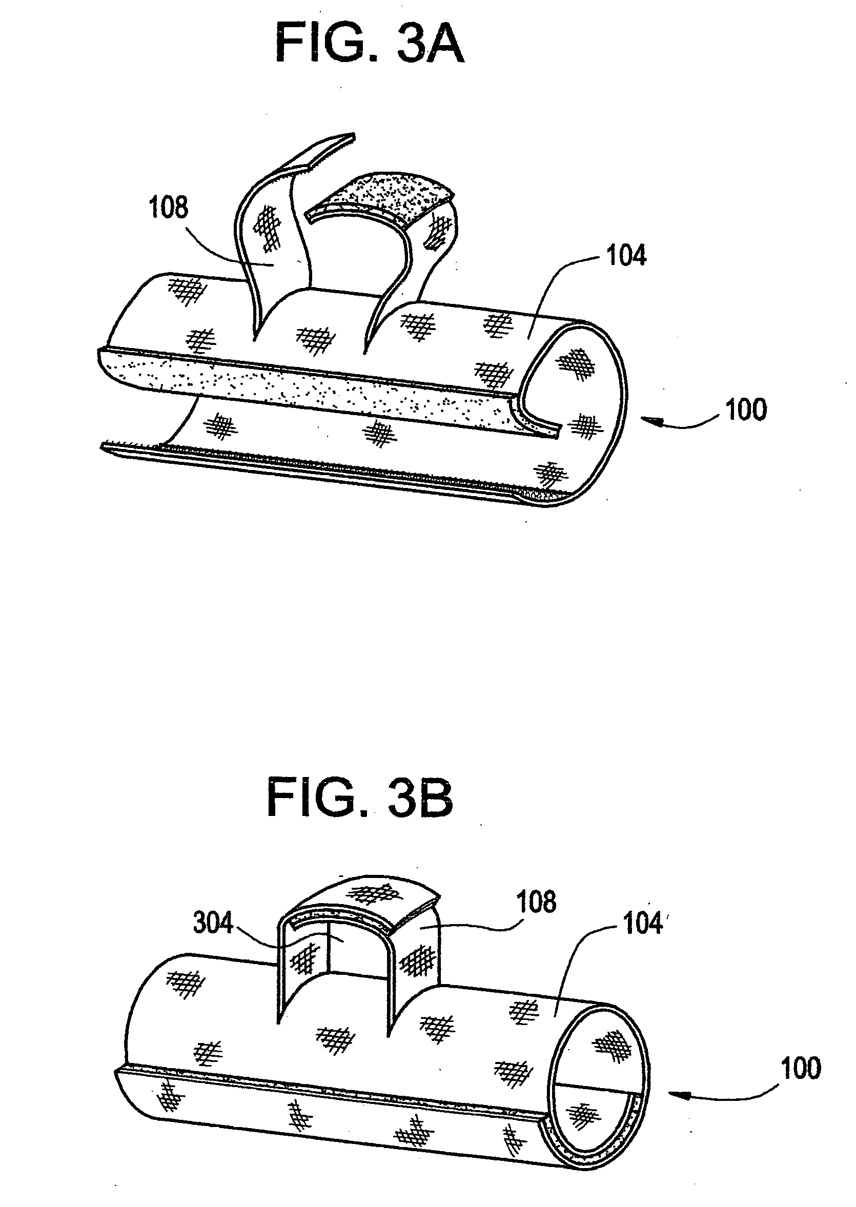 Intravenous tubing securing device for protecting tubing