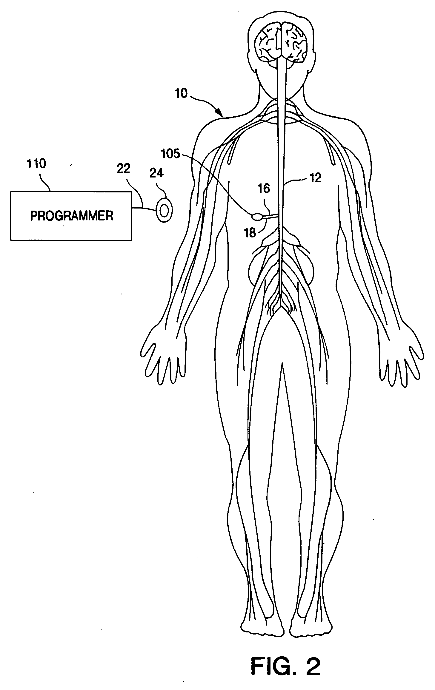 Therapy management techniques for an implantable medical device