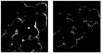 Preparation method of folic acid self-assembled water-soluble rare-earth doped up-converted nanometer material