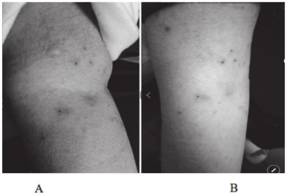 Aromatic plant composition for red, swollen, itching and pain of skin and preparation method of aromatic plant composition