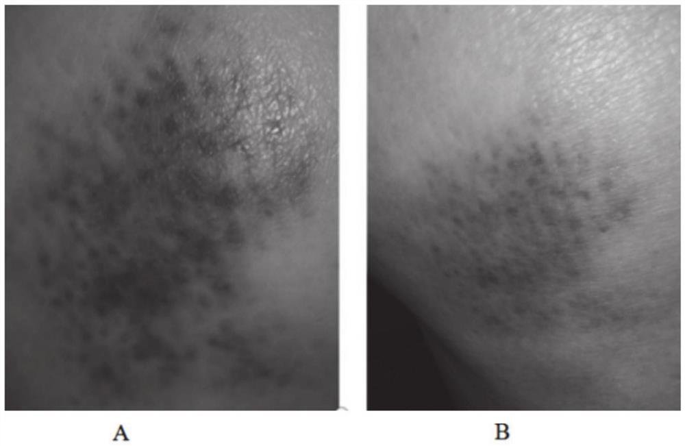 Aromatic plant composition for red, swollen, itching and pain of skin and preparation method of aromatic plant composition