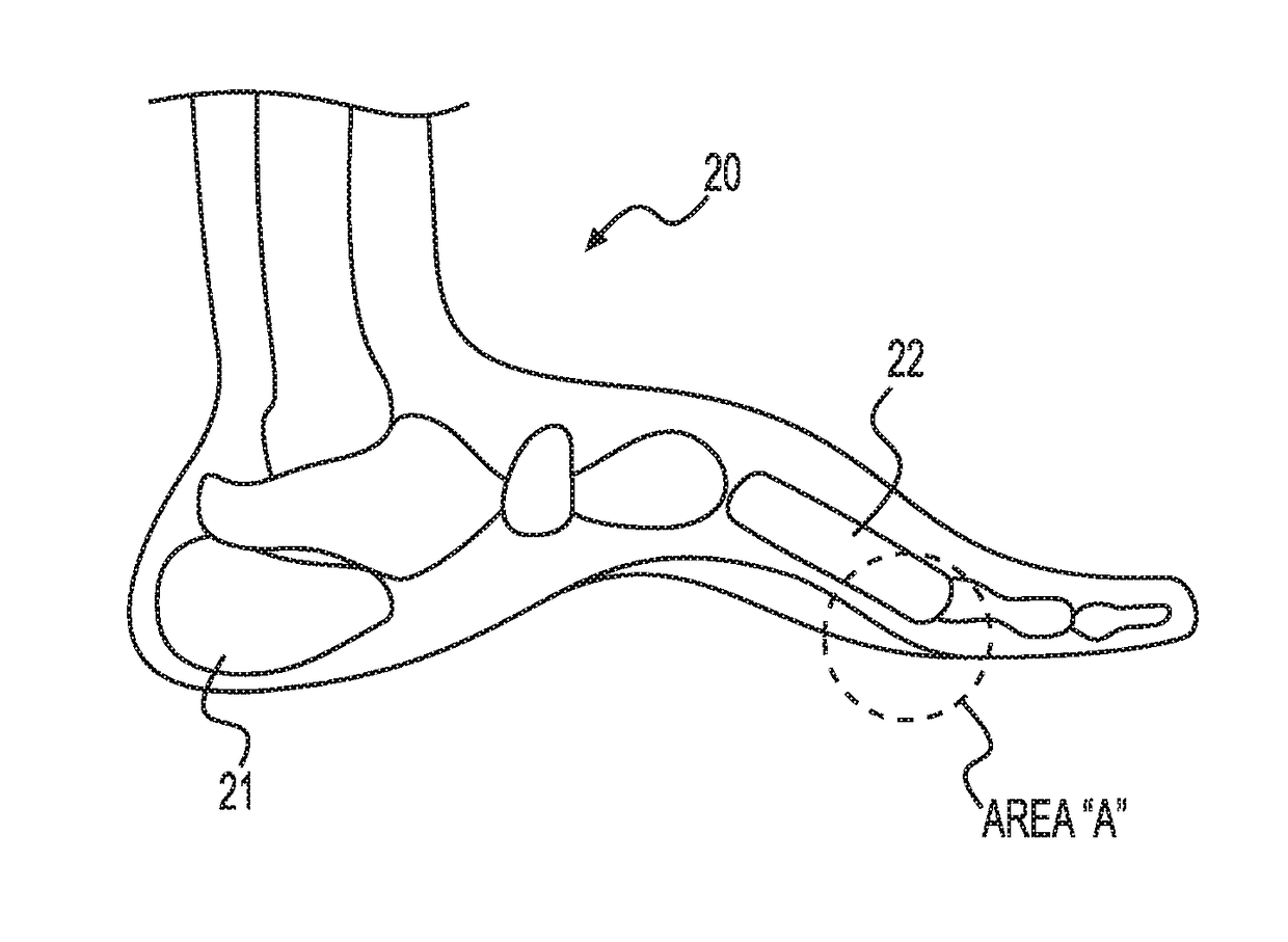 Measurement of susceptibility to diabetic foot ulcers