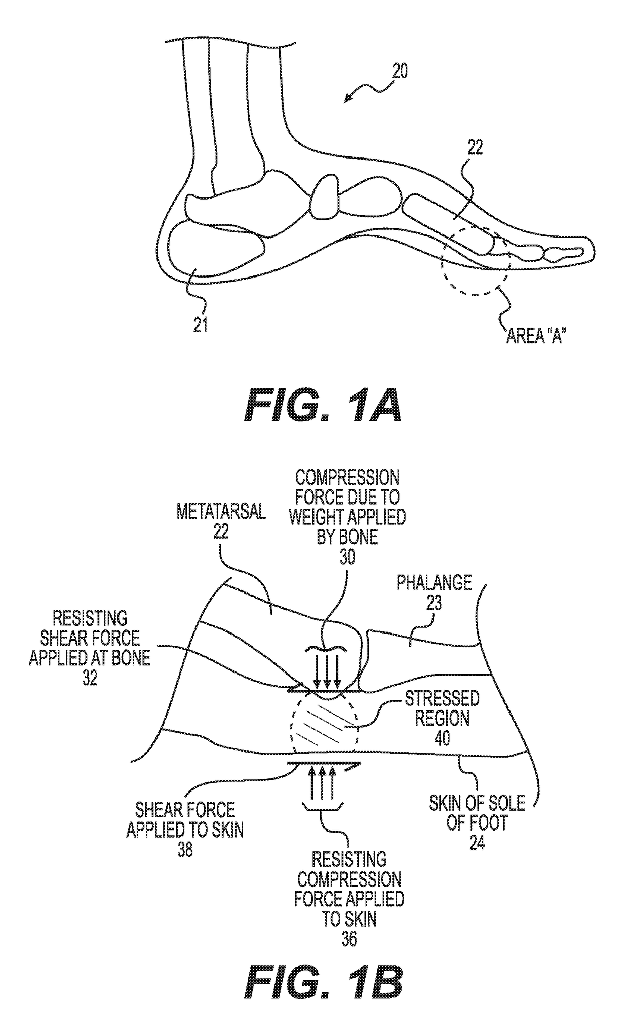 Measurement of susceptibility to diabetic foot ulcers