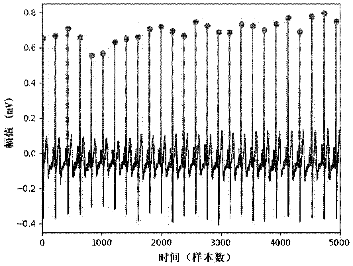 Sleep staging method based on electrocardiogram signals