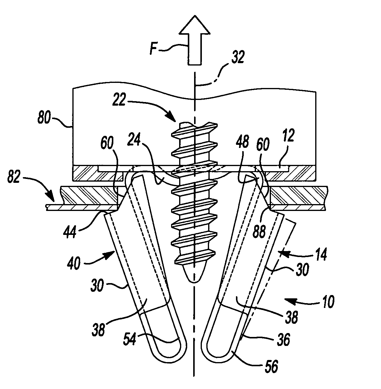 Resilient clip fastener