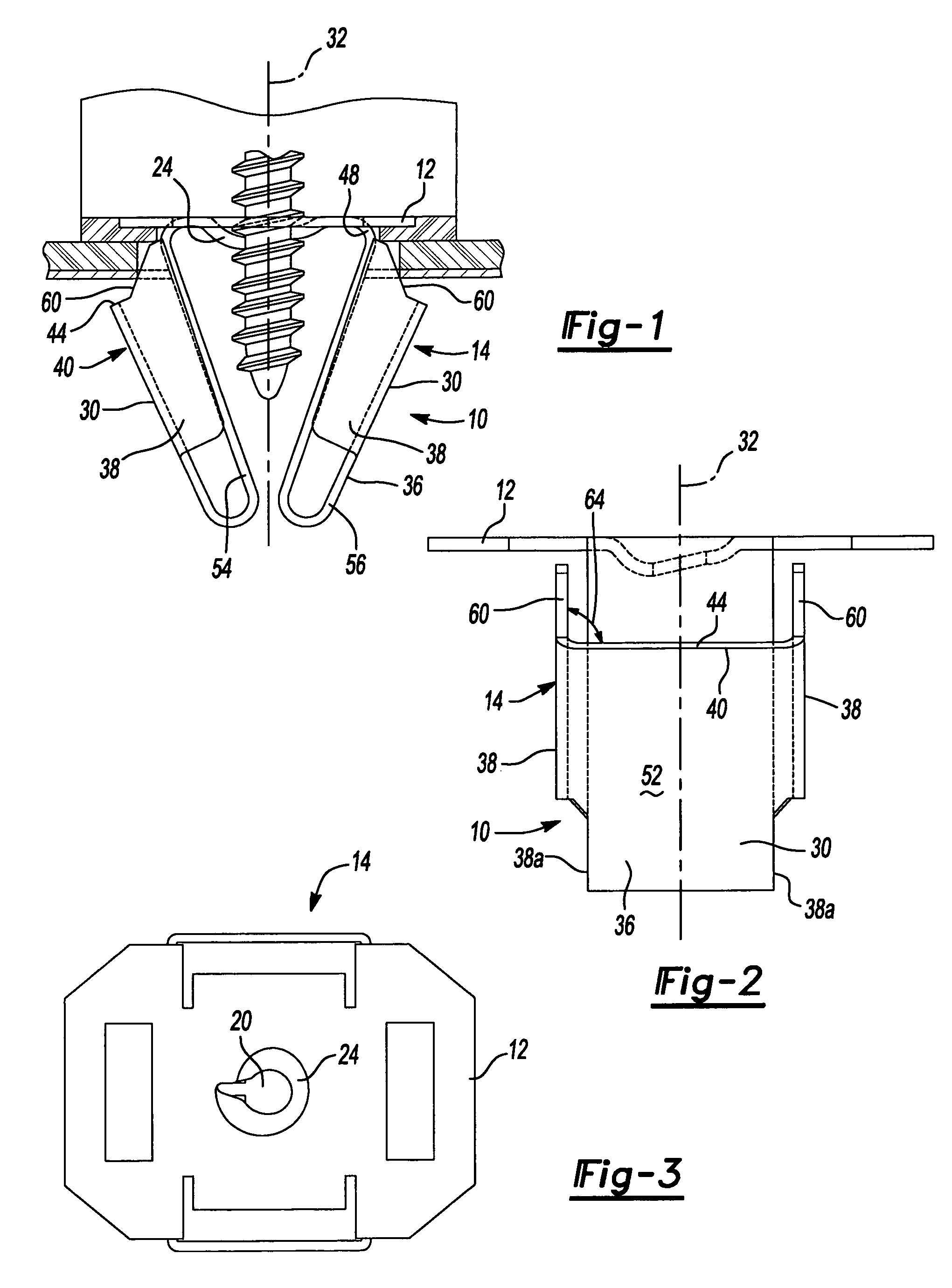 Resilient clip fastener