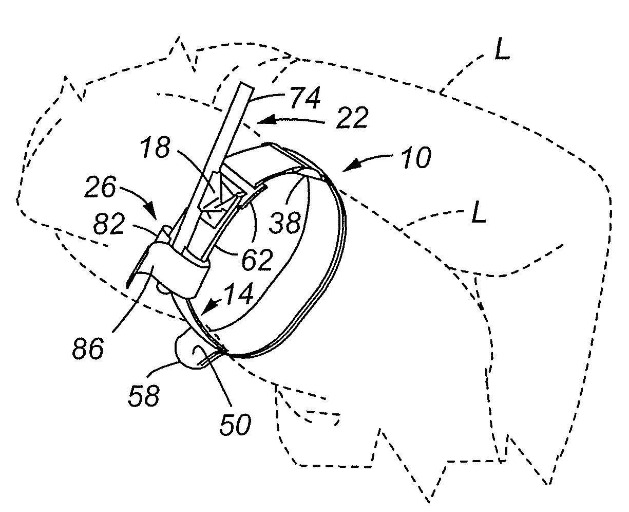 Training tourniquet and method of use