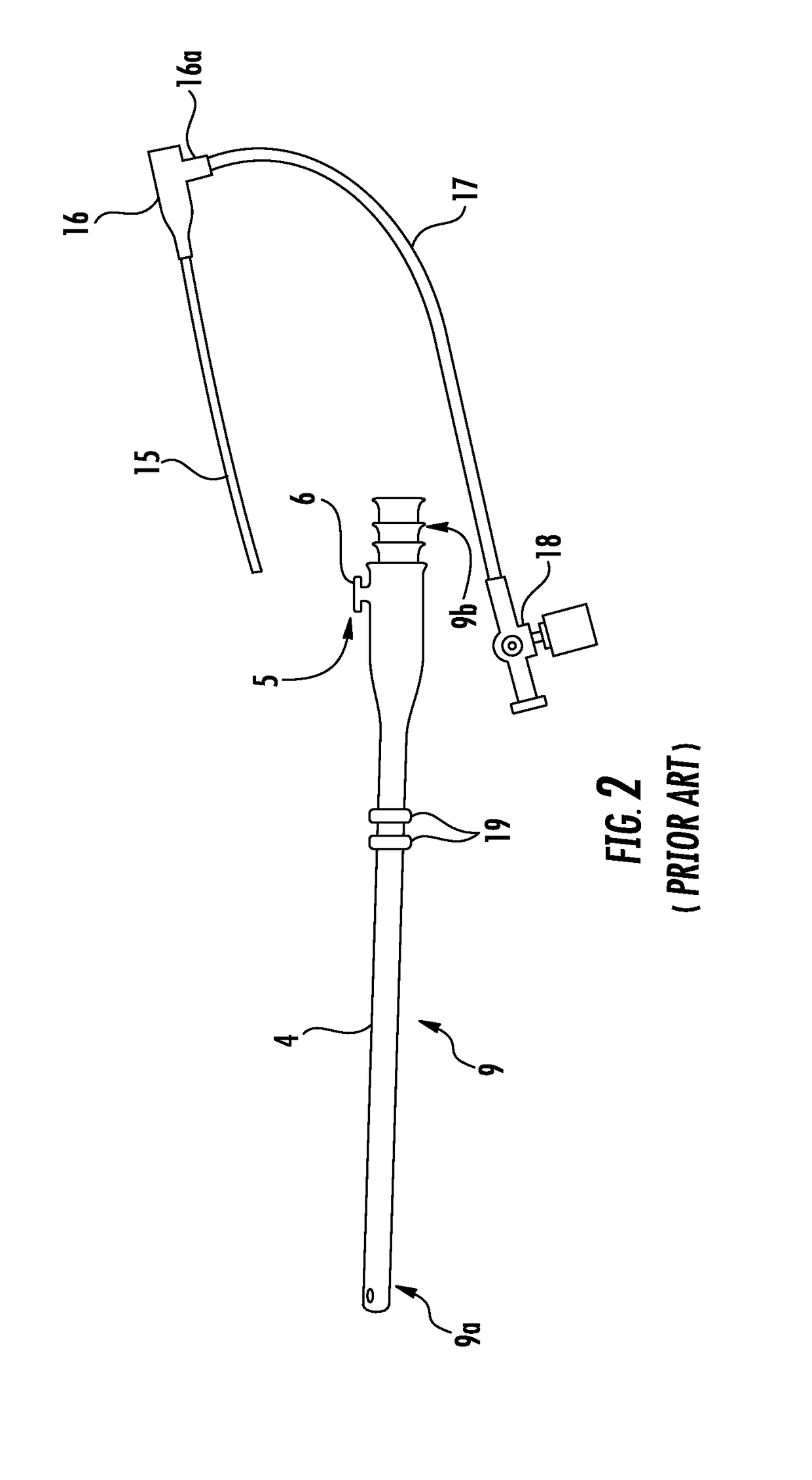 Devices for Endovascular Access Through Extracorporeal Life Support Circuits