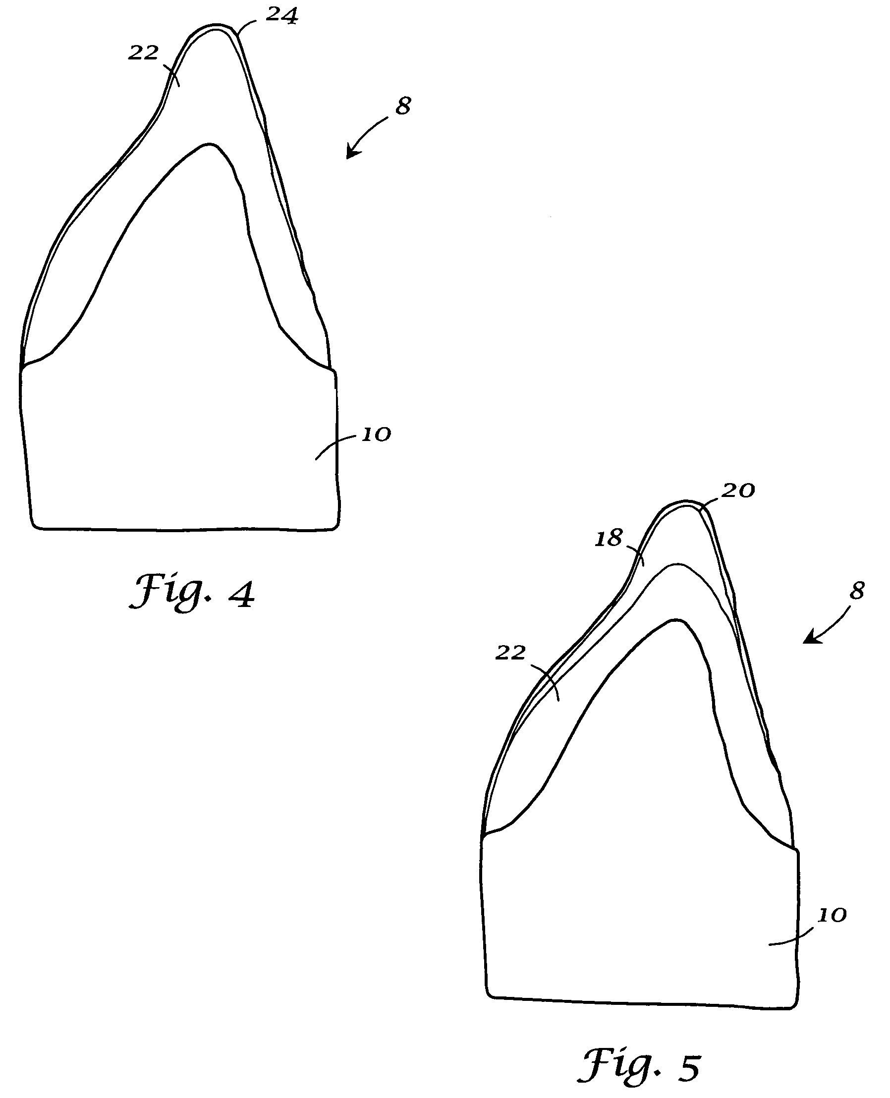 Integrated porcelain system for a dental prosthesis