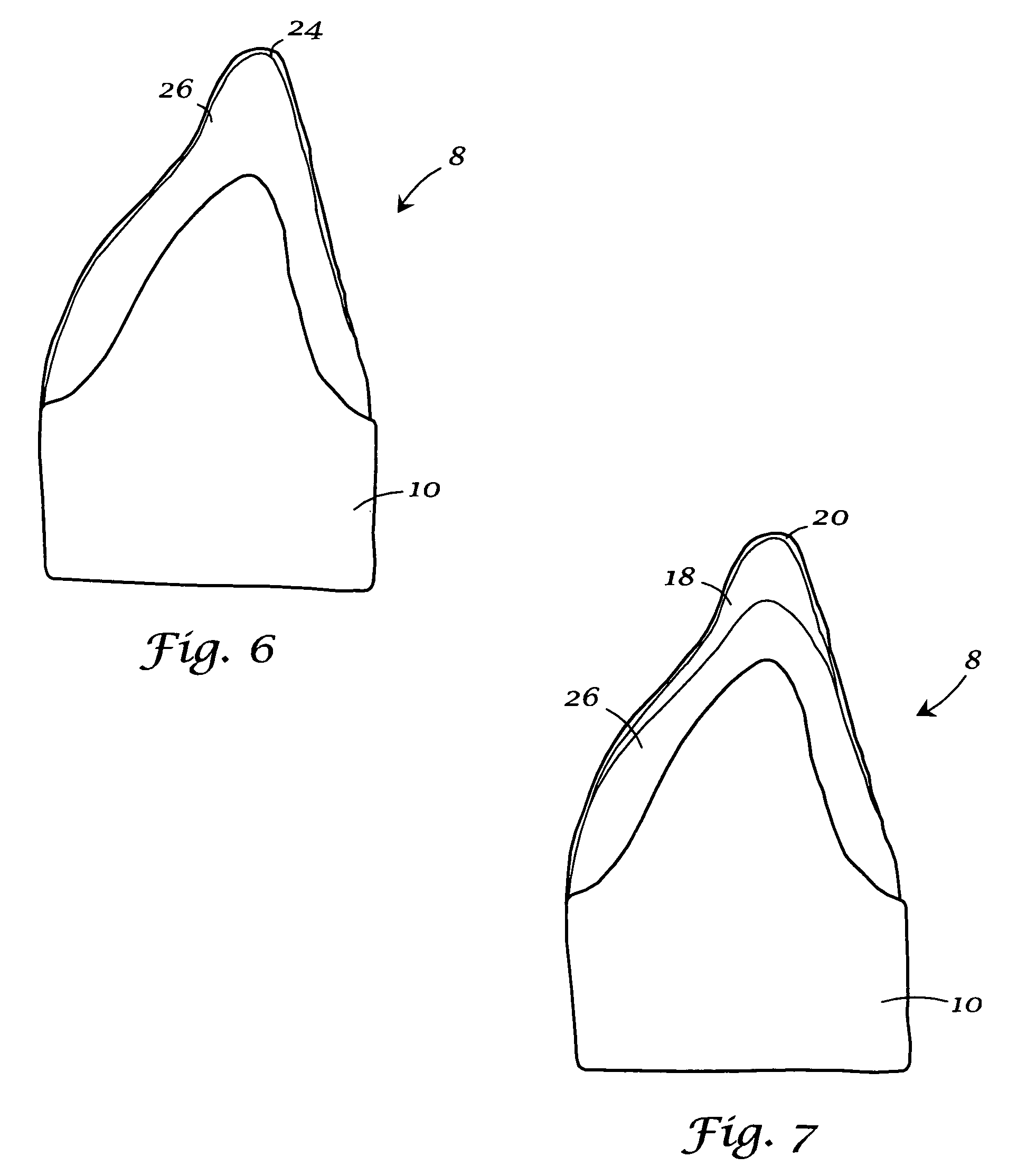 Integrated porcelain system for a dental prosthesis