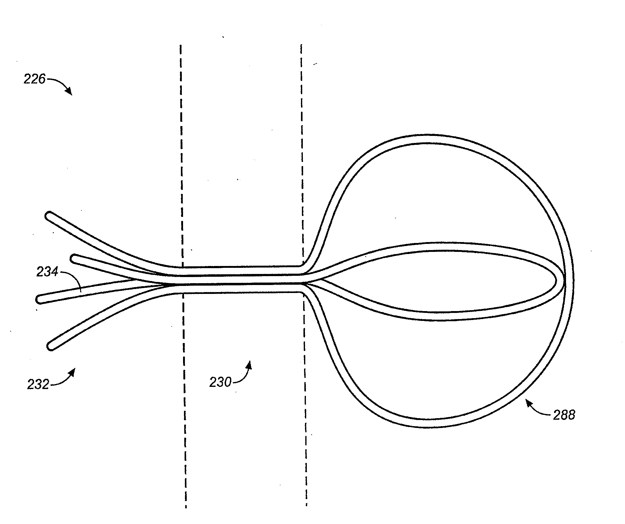 Device and methods for treating paranasal sinus conditions