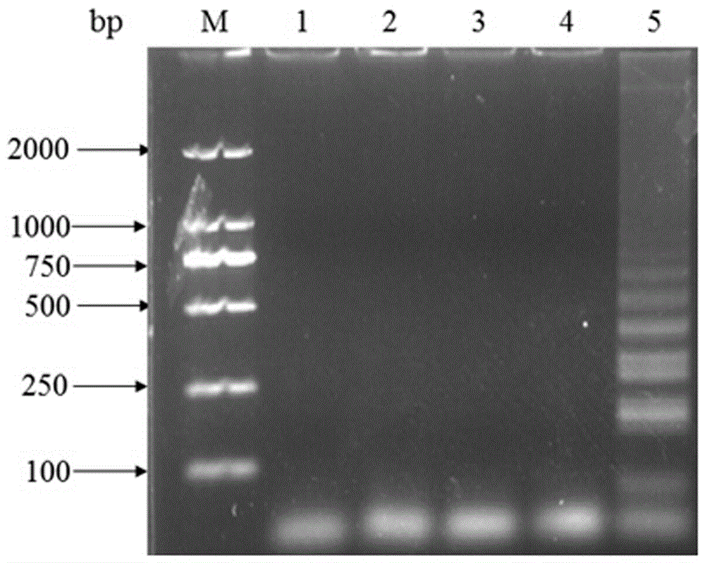 Reverse transcription loop-mediated isothermal amplification primer, kit and detection method for visually detecting Hobi-like pest virus