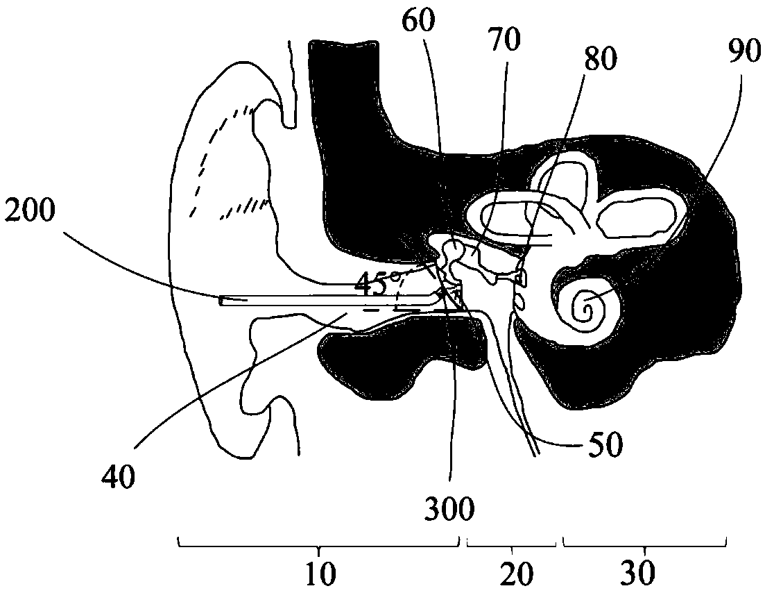 Preoperative evaluation tester for hearing compensation performance of artificial middle ear