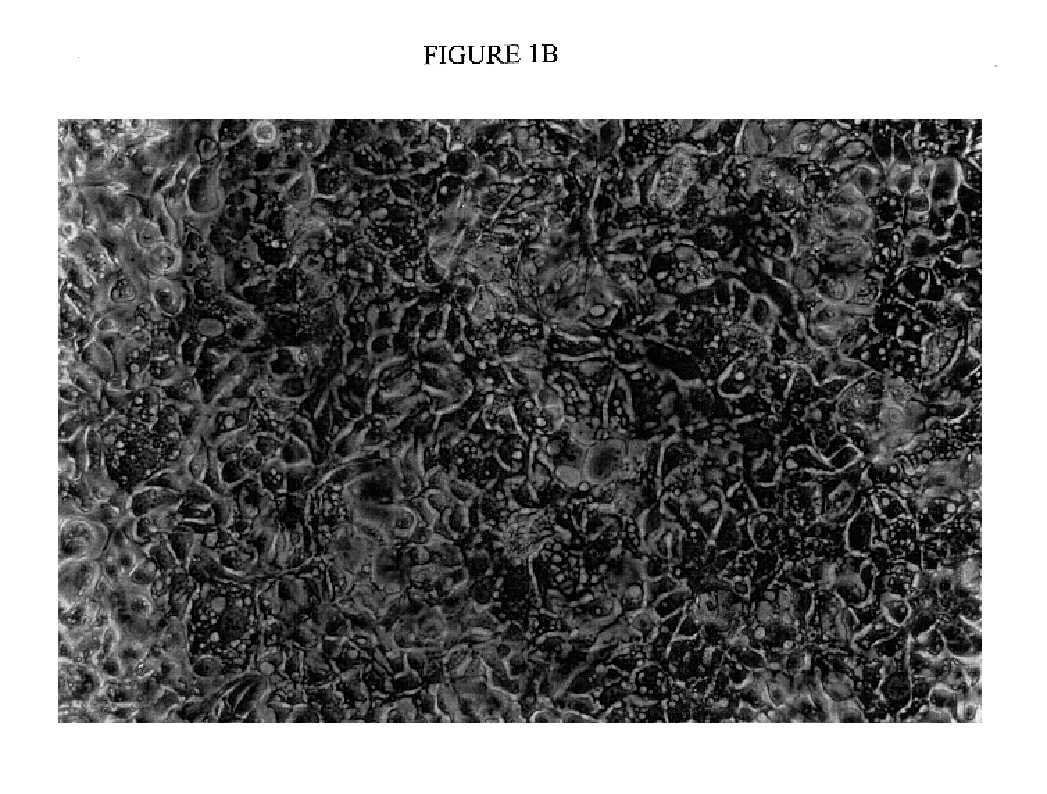 Immortal human prostate epithelial cell lines and clones and their applications in the research and therapy of prostate cancer