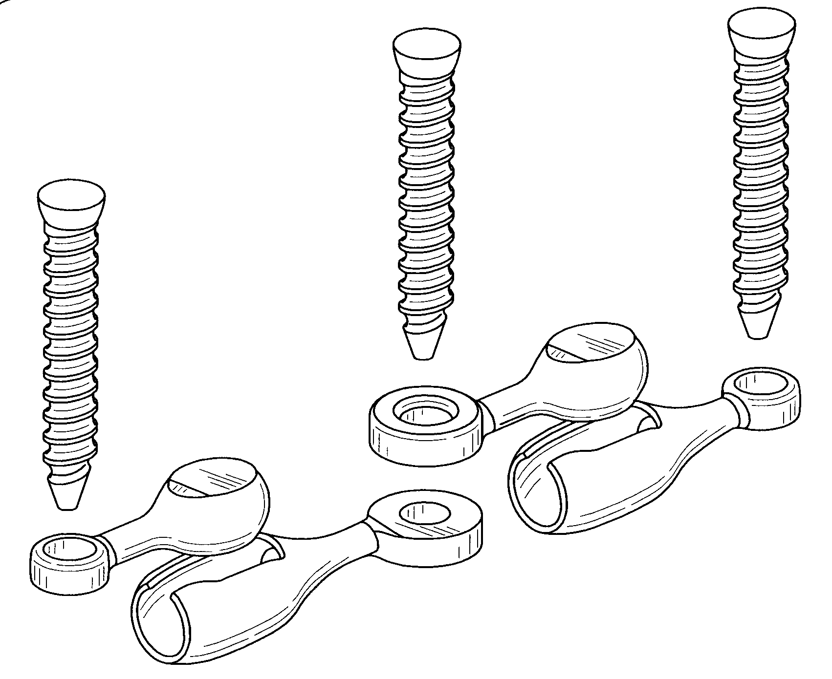 Facet joint prosthetic replacement and method